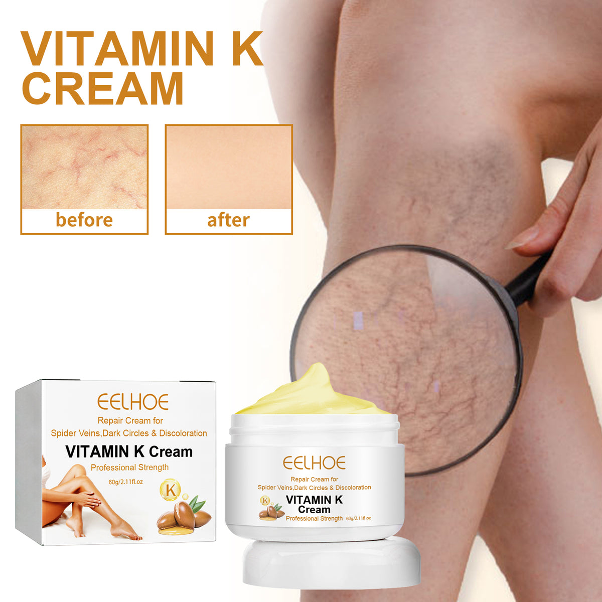 Vitamin K Cream Skin Care For Sore And Swollen Legs Earthworm Leg Vein Massage Cream