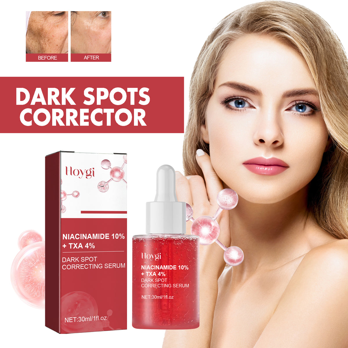 Hoygi Dark Spots Repair Essence, Moisturizing And Brightening Repair Essence For Dark Spots And Age Spots
