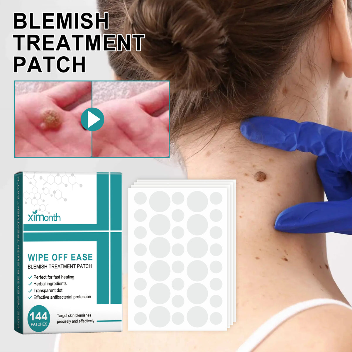 Blemish Treatment Patch, Fade Face Flesh Nevus Cure Warts Clean Body Smooth Skin Repair Corns Cure Warts Patch