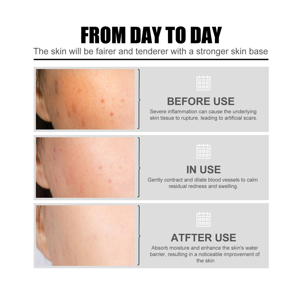 Nicotinic Acid Face Essence Lighten Acne Marks, Moisturize Pores, Shrink And Whiten Skin Beauty Essence