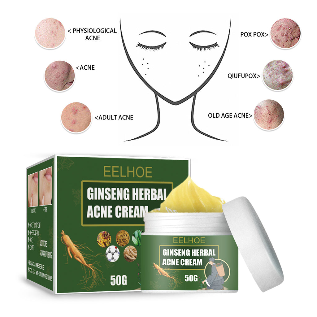Herbal Acne-Removing Cream Anti-acne-Removing Cream Moisturizing Cleansing Cream Water Oil Balance Anti-acne-Removing Cream