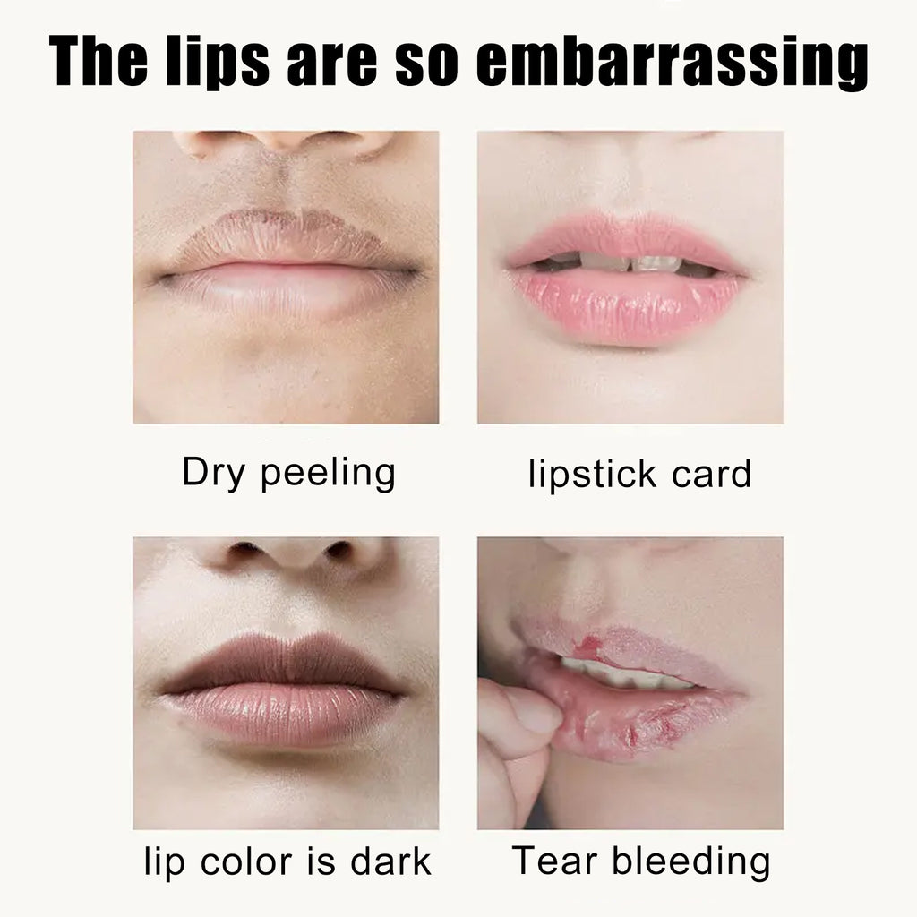 EELHOE Cherry Crystal Lip Mask Hydrates And Moisturizes Lips, Removes Dead Skin Without Greasy And Reduces Lip Lines