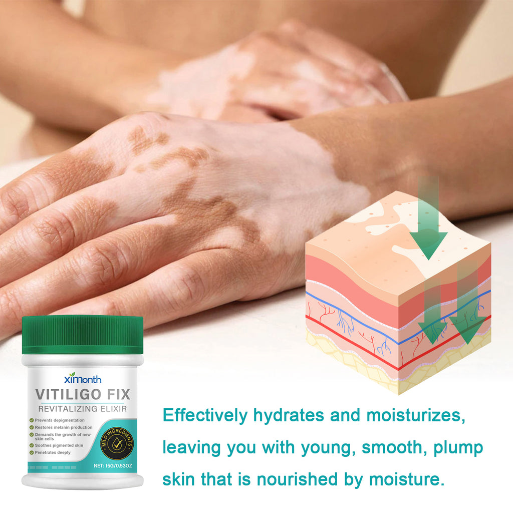 Vitiligo Fix Revitalizing Elixir, Lighten Skin Spots Even Skin Tone Moisturizing Body Care Repair Cream
