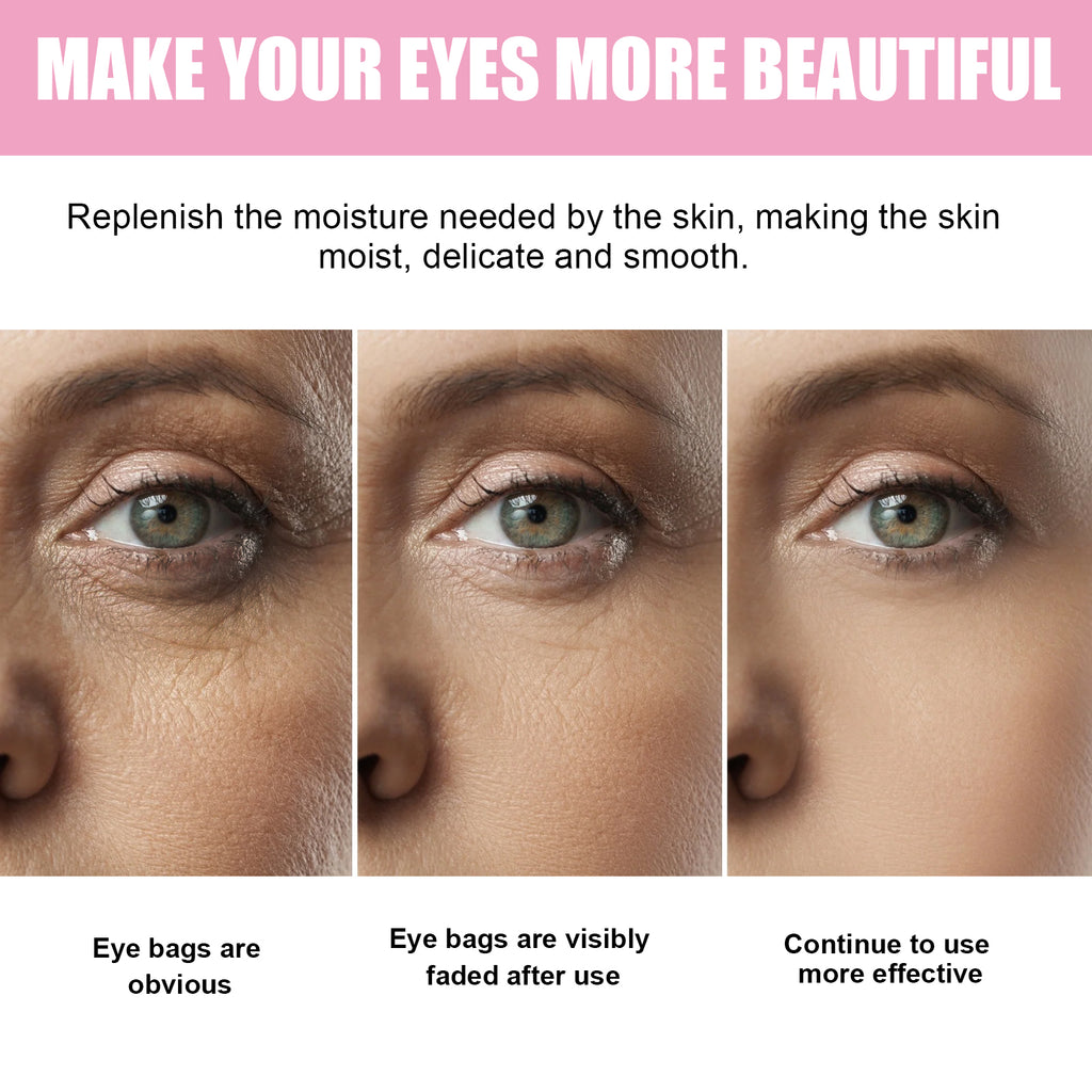 Sakura Dark Circle Eye Cream, Reduce Dark Eye Bags Around The Eyes Dull Brighten Moist Delicate Tight