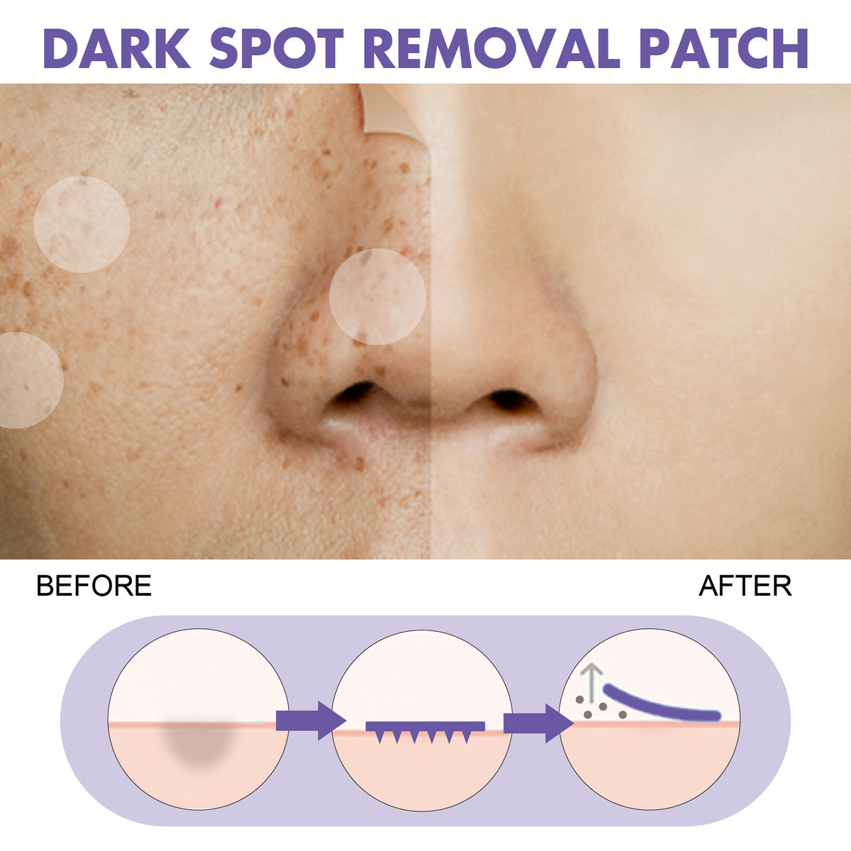 EELHOE Dark Spot Removal Patch, Lightening Face Dark Spots Melasma Spots Melanin Moisturizing Whitening Skin Spot Patch