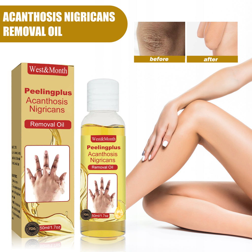 Acanthosis Nigricans Removal Oil, Exfoliating Light Black Brightening And Beauty Skin Oil