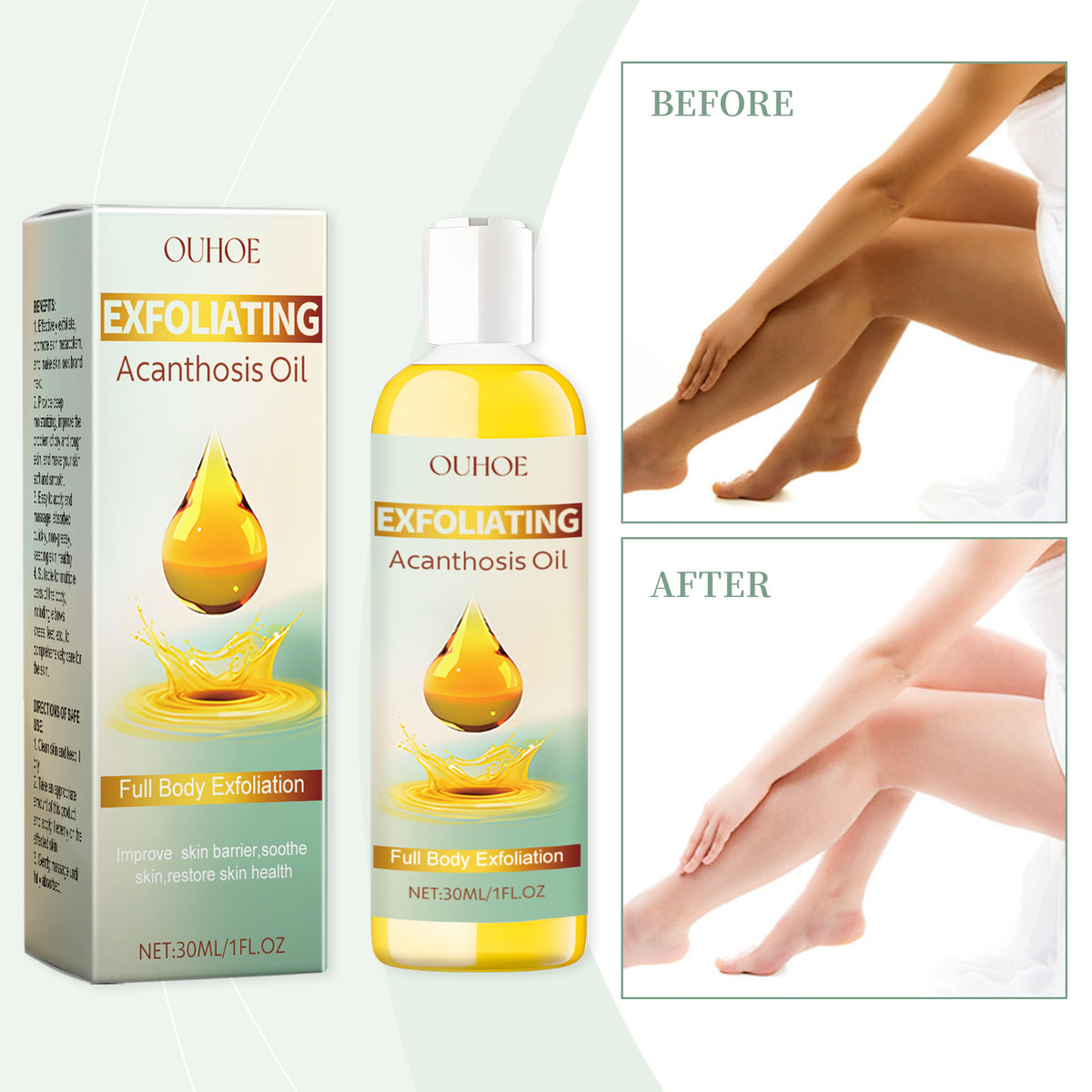 OUHOE Exfoliating Acanth Oil, Gentle Exfoliating Oil For Dull Armpit Elbow Joints