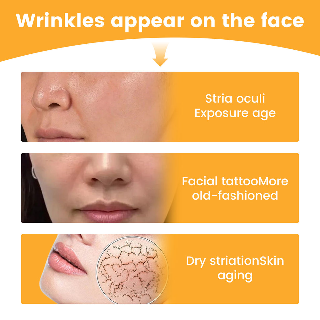 Nasolabial Folds Patch, Fade Fine Lines Law Lines Lifting And Tightening Facial Skin Moisturizing And Hydrating
