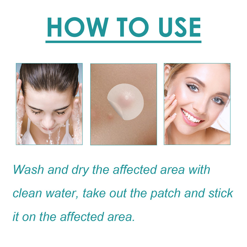 Blemish Treatment Patch, Fade Face Flesh Nevus Cure Warts Clean Body Smooth Skin Repair Corns Cure Warts Patch