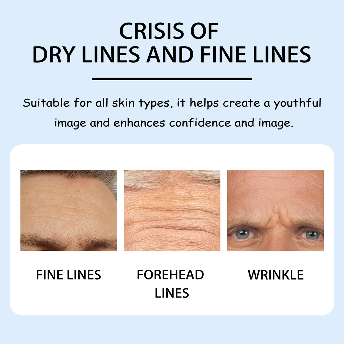Moisturizing Forehead Patch, Fade Forehead Wrinkles And Fine Lines Anti-Aging Moisturizing Skin Patch