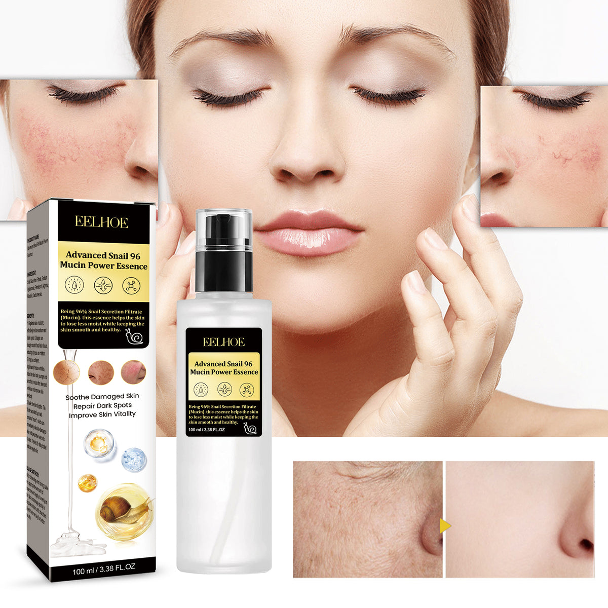 Snail 96 Collagen Essence Lighten Fine Lines, Tender Skin and Moisturize acne muscles