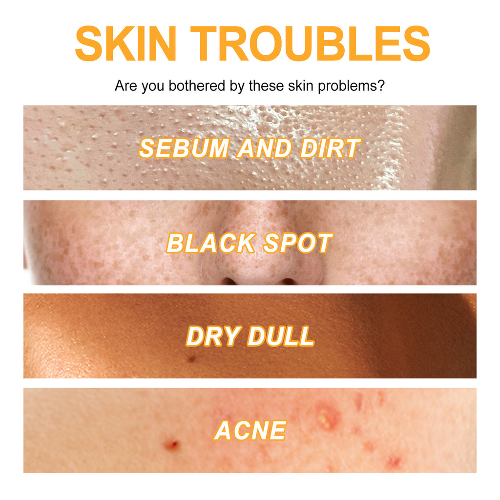 EELHOE Exfoliating Gel For Deep Cleansing, Anti-Acne Blackheads, Moisturizing Skin, Shrinking Pores And Brightening Gel