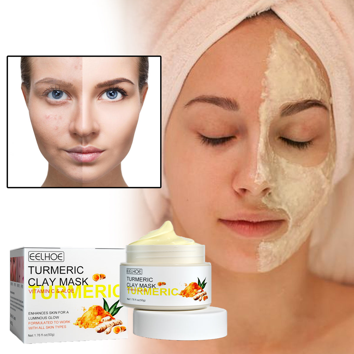 EELHOE Turmeric Clay Mask, Facial Acne-Clearing Q10 Deeply Cleanses, Hydrates, Brightens And Shrinks Pores