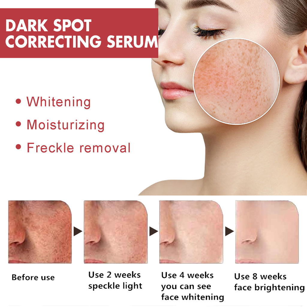 Hoygi Dark Spots Repair Essence, Moisturizing And Brightening Repair Essence For Dark Spots And Age Spots