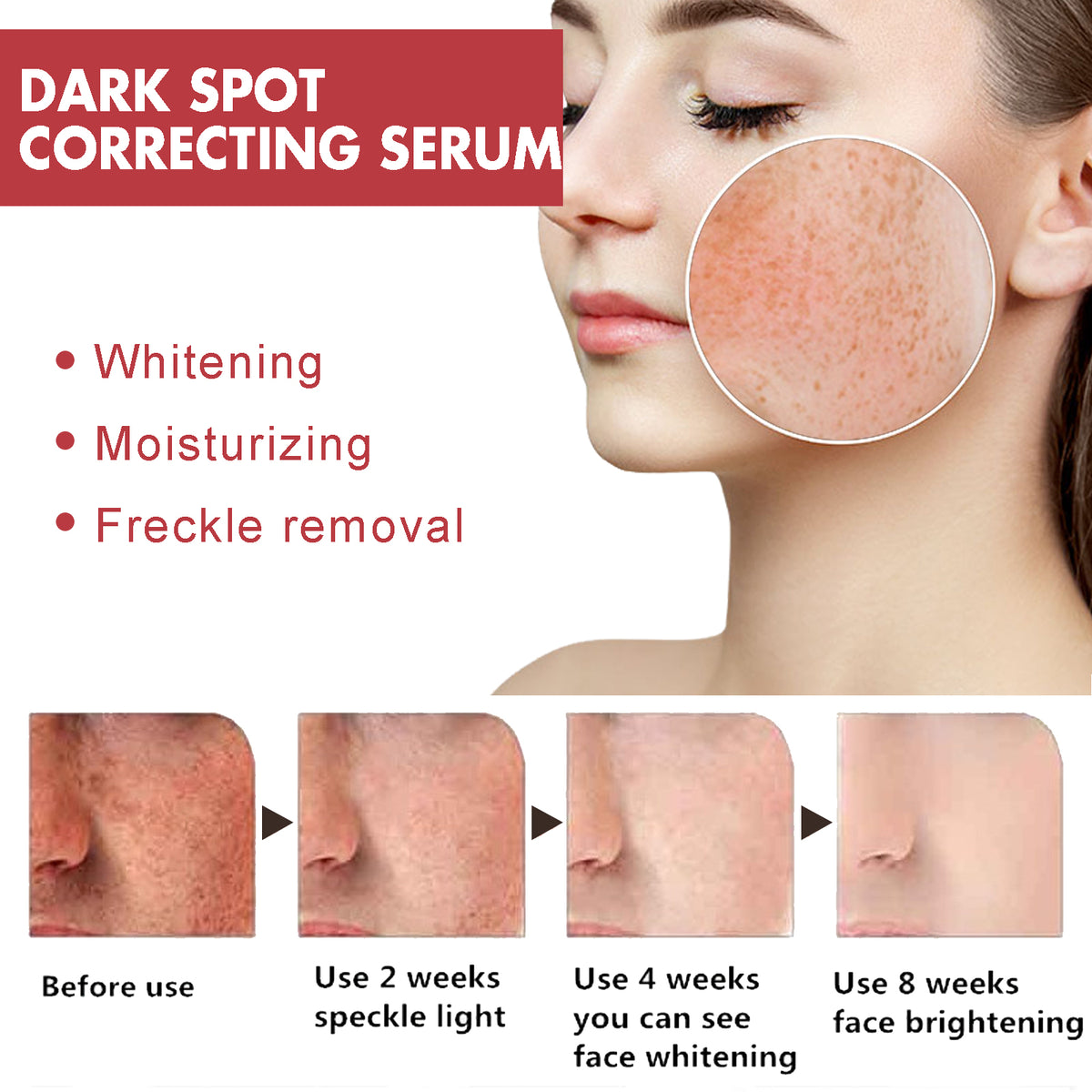 Hoygi Dark Spots Repair Essence, Moisturizing And Brightening Repair Essence For Dark Spots And Age Spots